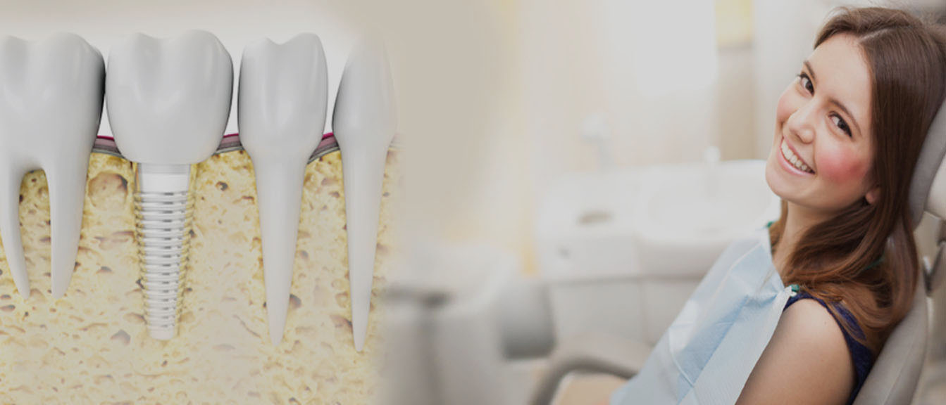 best dental implant clinic in bangalore