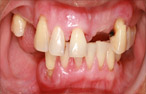 implant dentistry